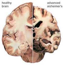 human brain
