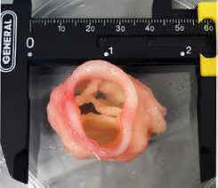 printing human organs