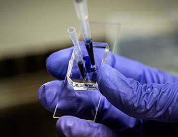 kidney-on-chip