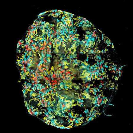 lab-grown kidney