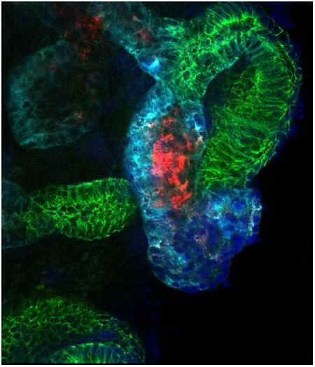 lab-grown kidney