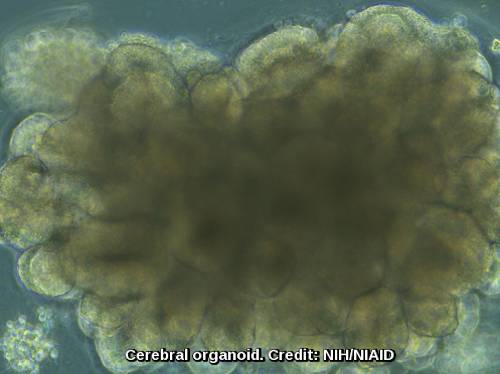 cerebral organoid
