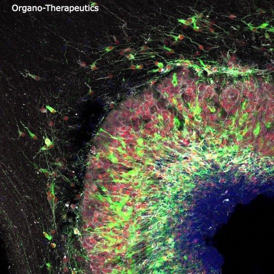 Organo-Therapeutics