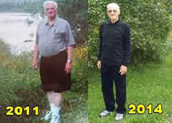 Esselstyn heart disease