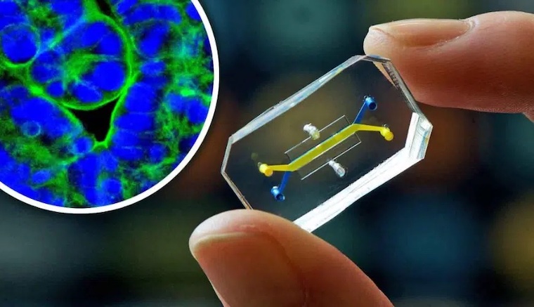 organoids