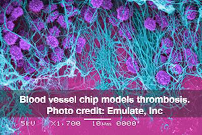 blood vessel chip