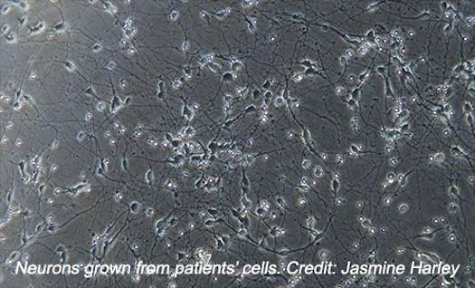 neurons