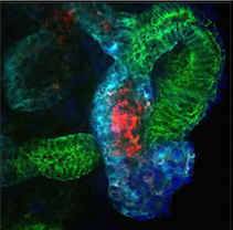 lab grown kidney